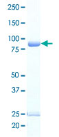 Loading 1 &mu;g protein in SDS-PAGE